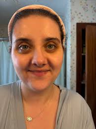 How to get rid of small facial bumps and blemishes?