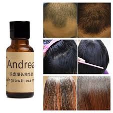 Choose the best hair serum like schwarzkopf professional at low price in india from top hair serum brands.original products. 20ml Andrea Hair Regrowth Essence Fast Growth Anti Hair Loss Buy Online In Sri Lanka At Desertcart Lk Productid 48675593