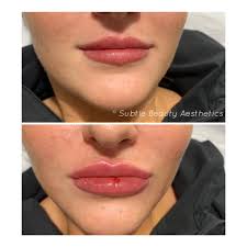 Subtle Beauty Aesthetics