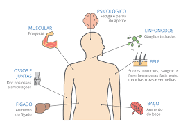 La leucemia linfocítica aguda es la más común en los niños. Leucemia Saiba Sobre O Cancer Que Afeta As Celulas Sanguineas