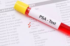 Maybe you would like to learn more about one of these? What Is The Difference Between Psa And Free Psa Harvard Health