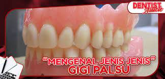 Sehingga pemakai jenis ini bisa kapan saja melepas gigi palsunya. Mengenal Jenis Jenis Gigi Palsu Dental Universe Indonesia