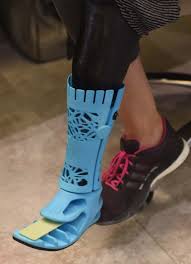 Therefore, the cost is not always the determinant as to whether the prosthetics are medically appropriate or not. Dubai Woman Gets Region S First Fully 3d Printed Prosthetic Leg Health Gulf News