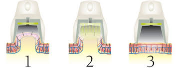 Solo plus 800hrp binary 800hrv. Dermatology Associates Of West Michigan
