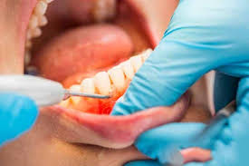 Pin On Dogal Cilt