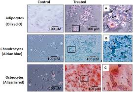 We did not find results for: Frontiers Pelleted Bone Marrow Derived Mesenchymal Stem Cells Are Better Protected From The Deleterious Effects Of Arthroscopic Heat Shock Physiology