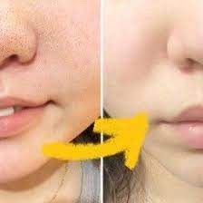 毛穴から角栓がにゅるっと流れ出る あの仲里依紗も効果を実感の毛穴ケアで素肌美人 スキンケア 毛穴 美容