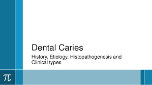 Dental Caries Dental Caries Dental Cari