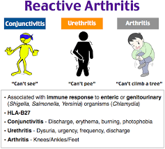 It was formerly known as reiter's syndrome. Rosh Review Reactive Arthritis Arthritis Nursing Diagnosis