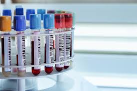 Blood tests that pick up these clues are being developed for a variety of different cancers, each relying on different markers. Cancer Id Hunts For Cancer Clues In Blood Samples Imi Innovative Medicines Initiative