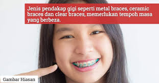 Lalu, mana jenis gigi palsu yang bagus? Berapa Lama Nak Kena Pakai Pendakap Gigi Ini Jawapannya