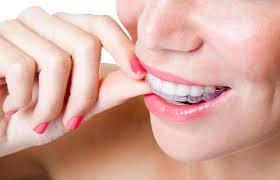 Clear braces, straighten teeth, invisible aligner How To Make Diy Braces Out Of Dental Floss Cigna Dental Plans