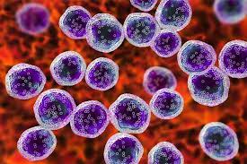 Kutanöz t hücreli lenfoma müştereken hodgkin dışı lenfoma adı verilen birkaç lenfoma türlerinden biridir. Hodgkin Disi Lenfoma Hdl Losemi Ise Bir Caresi Var