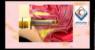 Youtube Private Hospitals Abha Hospital