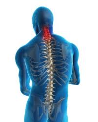 Image result for Spinal Shock