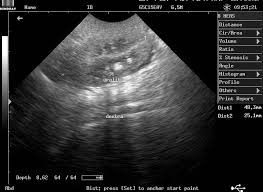 Maybe you would like to learn more about one of these? Https Ojs Unud Ac Id Index Php Jvet Article Download 43647 29466