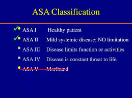 Image result for ASA Class