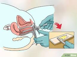 كيفية علاج الالتهابات المهبيلة المختلفة صور توضيحية Wikihow