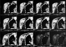 Image result for Incidental Imaging Finding