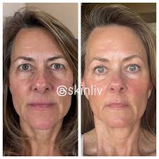 Leslie Joy Dammer (@skinliv) • Instagram photos and videos