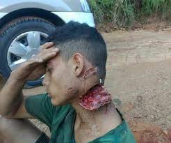 The web server software is running but no content has been added, yet. Lyam On Twitter Nasty Gash After Confrontation With A Gang Leaves Young Dude Partially Decapitated But Alive Gore Graphic Injury Gangs Brazil More Pics And Info At Documentingreality Https T Co 4wgbxyud5i Https T Co Rl1nppz60h