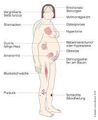 Cushing Syndrom Deximed
