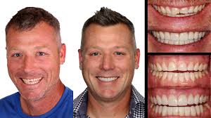 It's time to celebrate! Today is our wonderful dental hygienist Kristin's  birthday! We hope you'll join us in wishing her all the best today and in  the year ahead. Happy Birthday, Kristin!