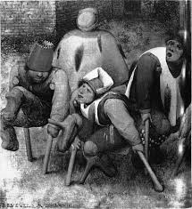 Image result for Ergotism