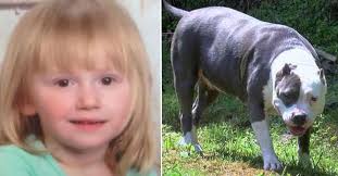 Kendi Cani Pahasina Insanlari Facialardan Kurtaran 9 Kahraman Pitbull
