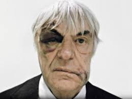 Buš viđen je sa masnicom na oku. Ecclestone Iskoristio Modricu I Snimio Reklamu