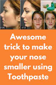 How to make your nose look smaller naturally for this amazing remedy, you need a teaspoon of toothpaste with a teaspoon of ground ginger and one tablespoon of apple cider vinegar. How To Get A Smaller Nose Arxiusarquitectura