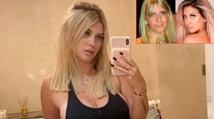 Jimena baron y el descargo por su antes y despues fisico lejos. Conocido Cirujano Contradijo A Wanda Nara Y Detallo Sus Cirugias Espectaculos Elonce Com