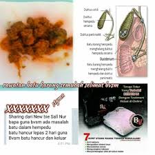 Di dalamnya terdapat sekitar 50 ml. Rawatan Batu Karang Tanpa Selimut Super Ajaib Facebook
