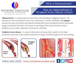 Pin On Western Vascular Institute
