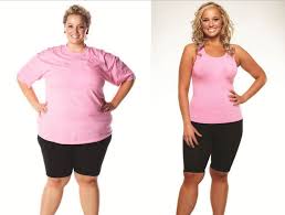 Weight Loss Surgery In Austin Bariatric Surgery Source