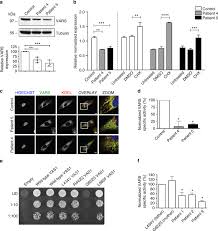 Package contents the following items should be included: Biallelic Vars Variants Cause Developmental Encephalopathy With Microcephaly That Is Recapitulated In Vars Knockout Zebrafish Nature Communications