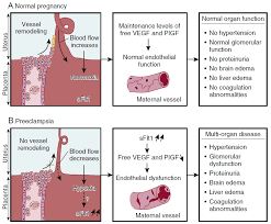 Kekurangan zat besi ketika hamil merupakan salah satu penyebab anemia pada ibu hamil. Http Kebidanan Poltekkes Smg Ac Id Wp Content Uploads 2019 03 Materi 2 Dr Dr Haidar Pdf