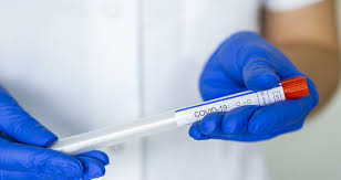 Estos test son los que se deben realizar cuando una persona presenta síntomas de covid 19. Prelevarea Probelor Pentru Testarea Covid 19 La Domiciliu Medicii Sunt IngrijoraÈ›i Iar Ministerul DÄƒ AsigurÄƒri CÄƒ Echipele Sunt Dotate CorespunzÄƒtor Ziarul De GardÄƒ