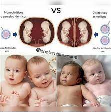 Mama Posmoderna Ovulos Fertilizados En El Caso De Gemelos Identicos Y De Mellizos Infografia