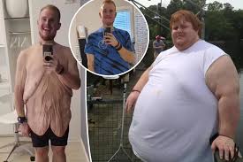 Obese reality star Casey King loses 600 pounds in life ...