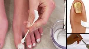 ⬇ baixe fotos de unha fungo no enorme banco de imagens ✔ milhões de fotos ✔ imagens, ilustrações livres de royalties de alta qualidade a preços acessíveis. Fungos Nas Unhas Receitas Caseiras Mistura Geral