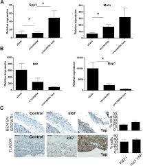 Table of contents open the table of contents. How Asbestos Drives The Tissue Towards Tumors Yap Activation Macrophage And Mesothelial Precursor Recruitment Rna Editing And Somatic Mutations Biorxiv