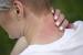 Scabies Itchy Bumps On Skin Like Mosquito Bites