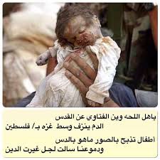 بعض التخصصات الأخرى تنطوي على بعض صور التدخل الجراحي خصوصا أمراض النساء، أيضا بعض الناس ينظر إلى طرق العلاج الغازية أو التشخيص كقسطرة القلب والتنظير ووضع أنابيب الصدر أو وضع الخطوط. Ù…Ø¨Ø§Ø±Ú† On Twitter Ù„Ù‚Ø¯ Ø´Ø§Ø¨ Ø´Ø¹Ø± Ø§Ù„Ø·ÙÙ„ Ø¨Ù…Ø§ÙŠØ­Ø¯Ø« Ø¨Ø§Ù„Ù…Ø³Ù„Ù…ÙŠÙ† ÙÙŠ ØºØ²Ø© ØµÙˆØ±Ø© ØªÙ‚Ø·Ø¹ Ø§Ù„Ù‚Ù„Ø¨ ÙˆØªØ±Ø¶Ø® Ø§Ù„Ø¹ÙŠÙ† Ù„Ù„Ø¯Ù…ÙˆØ¹ ÙˆØªØµÙÙØª Ø§Ù„Ø§Ø¨ÙŠØ§Øª Ù…Ù† Ø§Ù„Ø­Ø²Ù† ØªØ¬Ø§Ù‡Ù‡Ù… Ø±ÙŠØªÙˆÙŠØª Http T Co Djjognkmmx