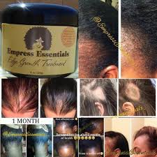 First of all, hair castor oil contains high amounts of ricinoleic acid that can help to keep the hair and scalp moisturized while also strengthening strands. Hair Loss Treatment Hair Growth Cream 2 Month Supply Balding Etsy