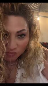 Mi Caida Pero Solo Me Raspe La Rodilla