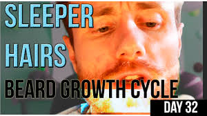3 ﻿ at any time, about 80 percent to 90 percent of the hairs on your head are in the anagen phase. Sleeper Hairs How They Will Improve Your Beard Game Hair Growth Cycle Thin Patchy Advice Youtube