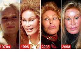 Anda adam a exagerat cu operatiile estetice. Zece Vedete Care È™i Au Distrus Chipul Prin OperaÈ›iile Estetice