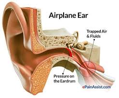 How to prevent ears popping on airplanes? Pin By Mohamad Samir On Anatomy Ear Pressure Relief How To Pop Ears Tinnitus Symptoms