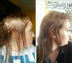 Before And After Hair Growth Result Biotin And Collagen Shampoo Pin En Nuskin Products